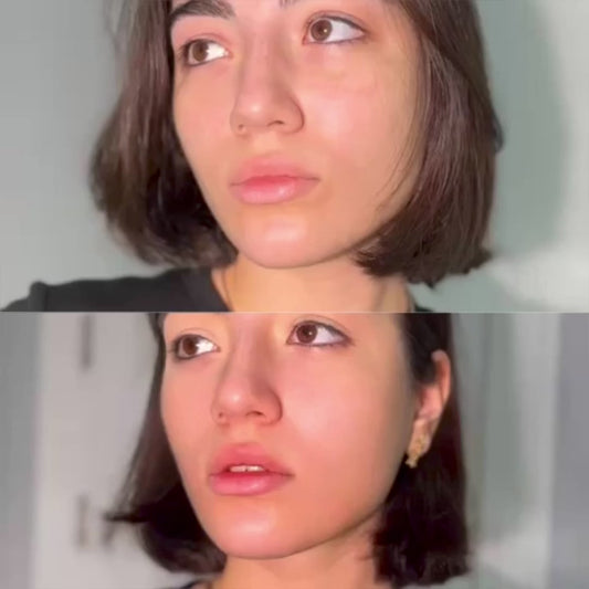 Anti-Aging Collagen Moisturizer